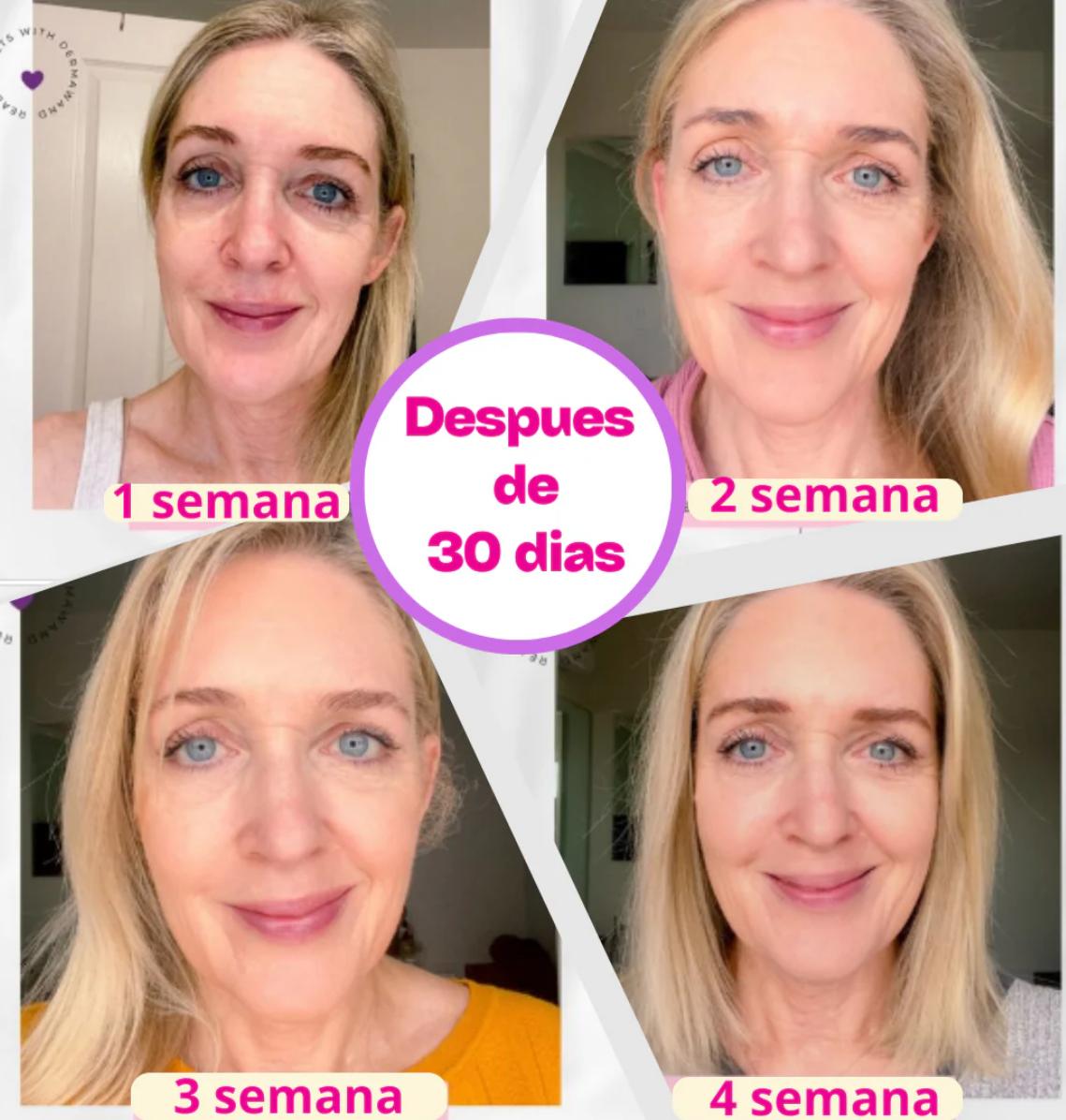 DermaWand PRO – Renueva tu rostro sin agujas ni cirugías