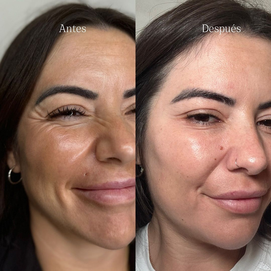Trataamiento Antiedad – Resveratrol Líquido, Juventud en una Gota